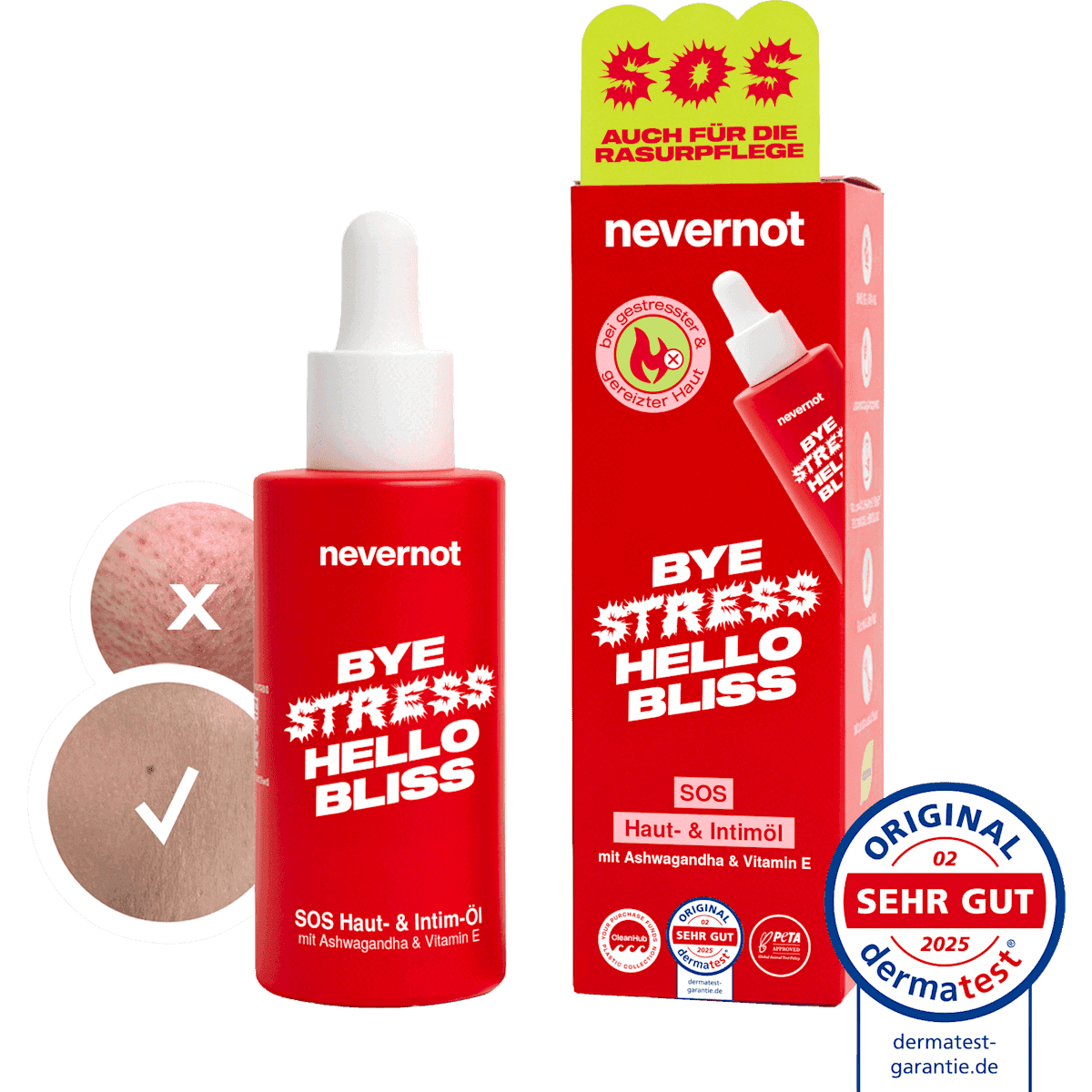 nevernot Huile corporelle SOS Skin Oil, 30 ml — produit allemand authentique au Maroc
